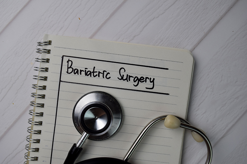 Bariatric Surgery written on a notepad with a stethoscope